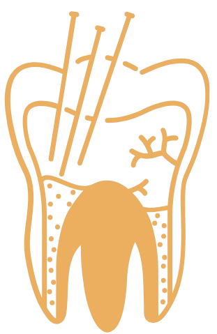 Filling icon at SAMDENT